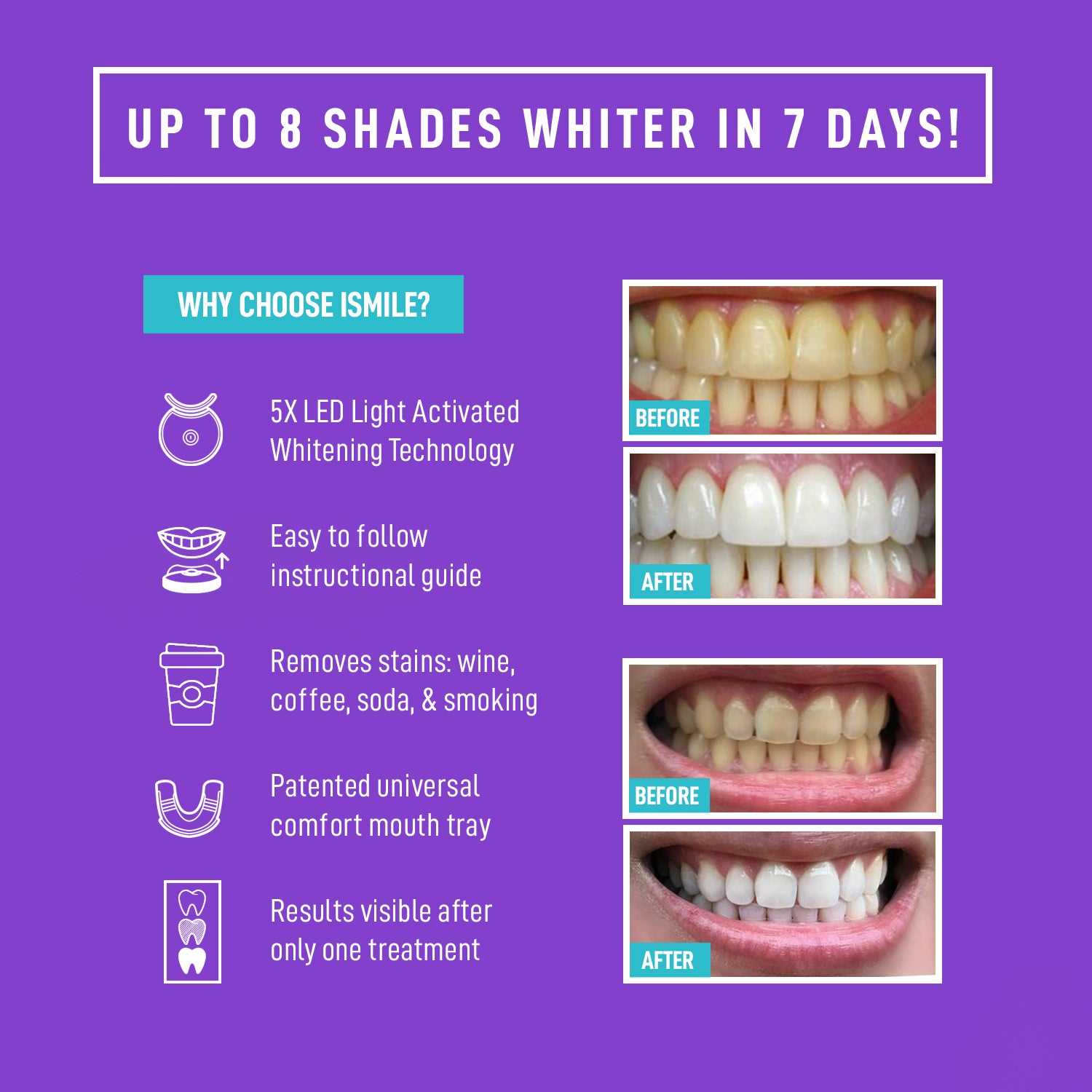 i want white teeth k&auml;ytt&ouml;ohje